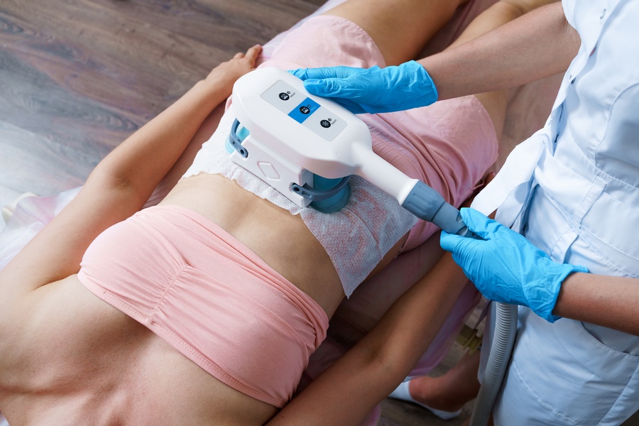 A clinician applying a fat-freezing applicator to a client's abdomen