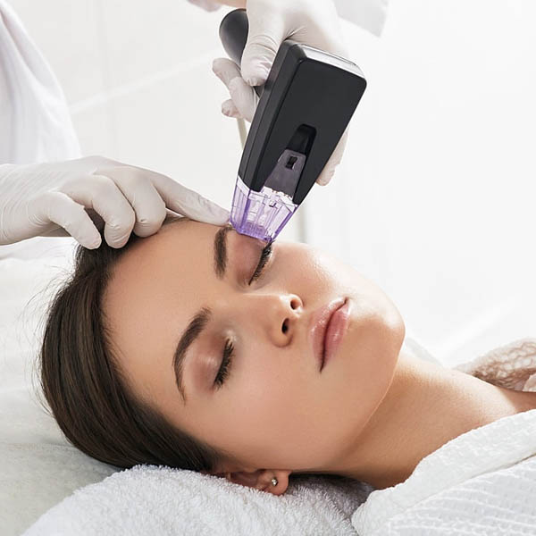 Close-up of Morpheus8 radiofrequency microneedling treatment
