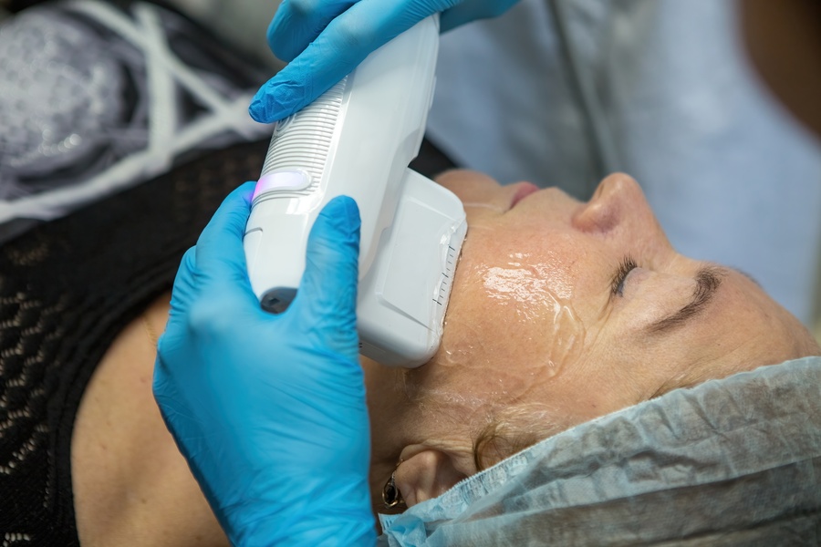 A clinician carrying out a Morpheus8 facial treatment