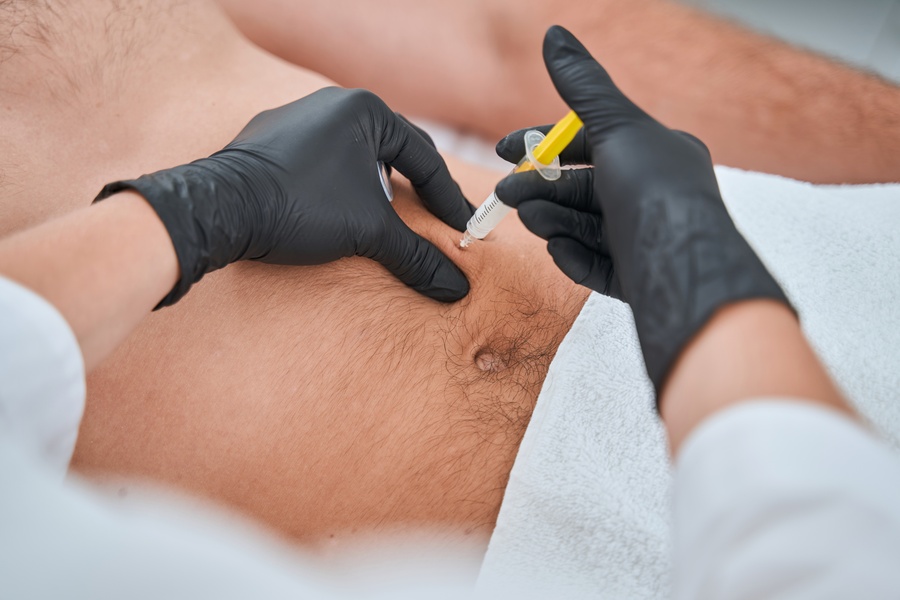 Certified Aesthetic Doctor Carrying Out A Mesolipo