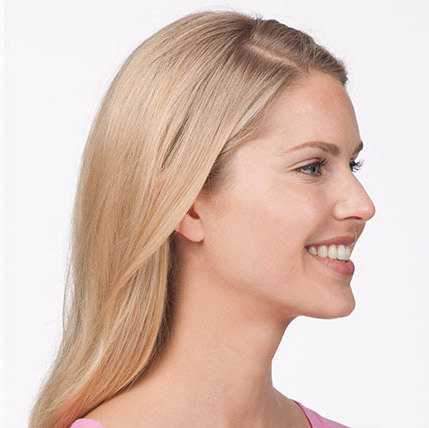 Botox After